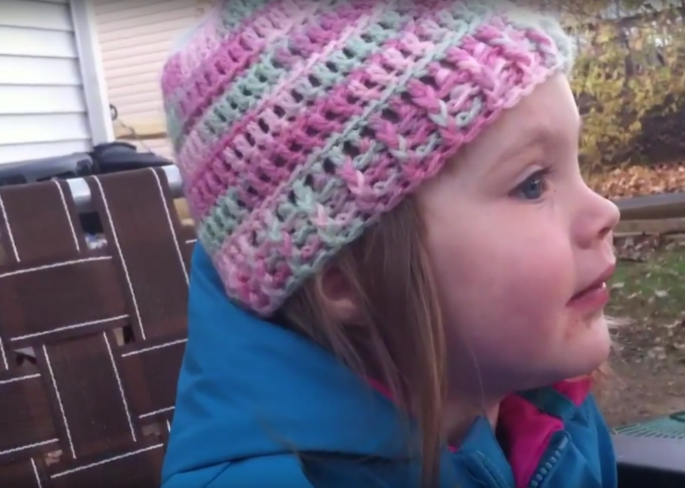 child with irritated skin wearing beanie
